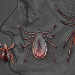 Test: M&aacute;te Lymsk&uacute; Boreli&oacute;zu?