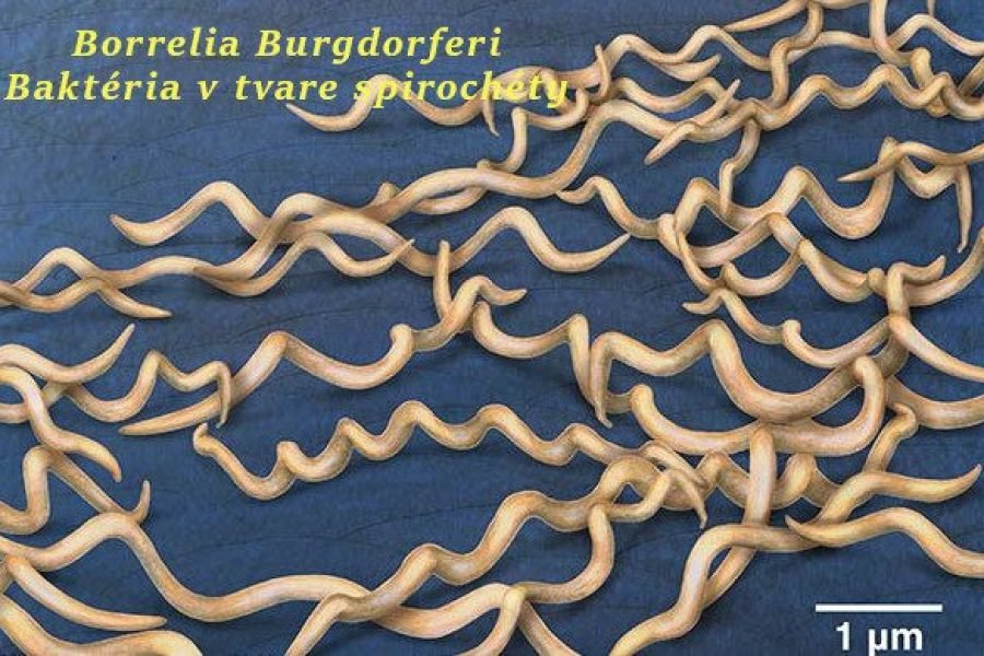 Minerálny kompas pre telo v zápale: Ca–Mg–Zn–B–D3–K2 a ich význam pri chronickej borelióze