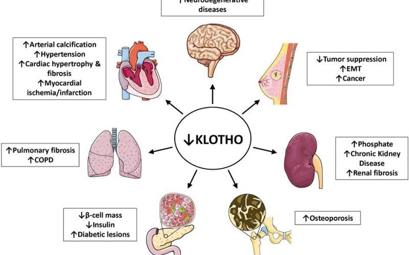 Klotho, starnutie a zlyh&aacute;vaj&uacute;ca oblička