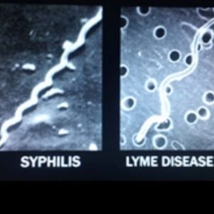Borrelia burgdorferi&nbsp;a&nbsp;Treponema pallidum&nbsp;: porovnanie